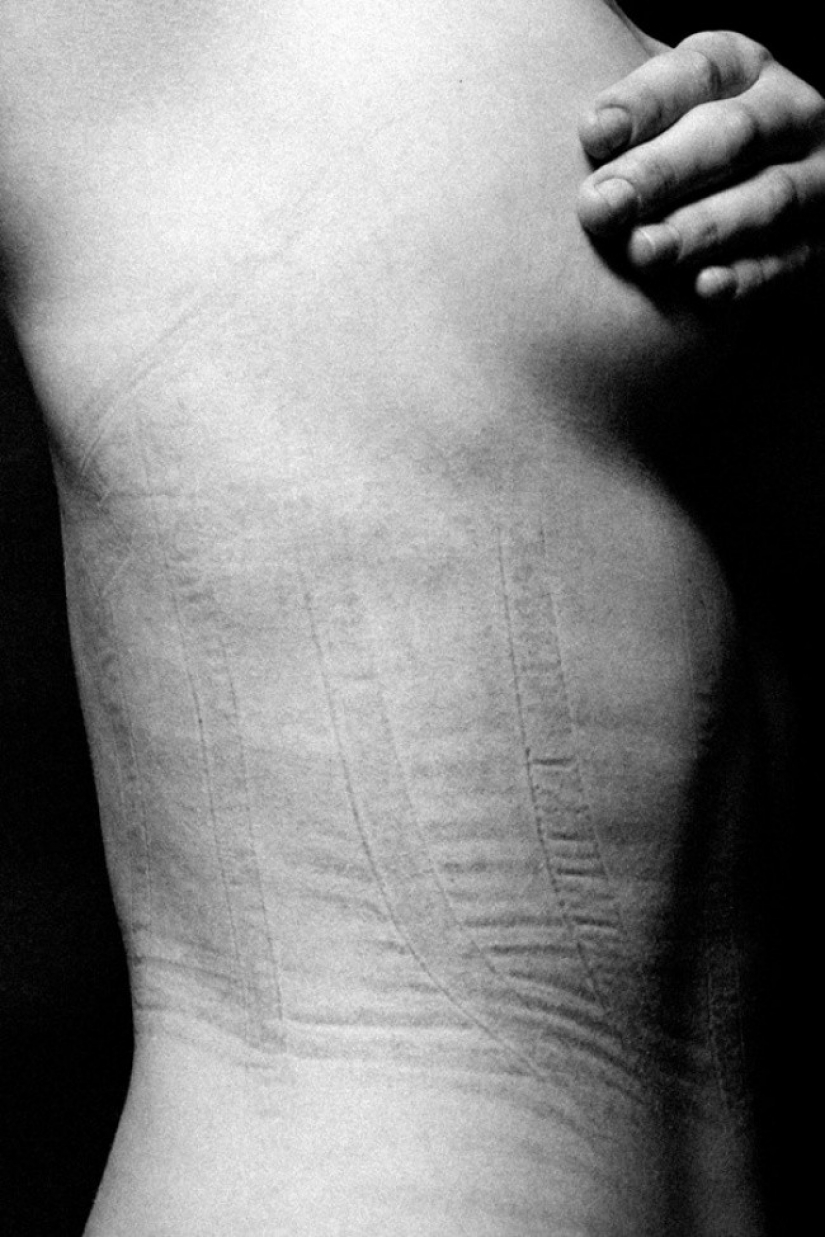 This is what lies behind the female splendor. On these photos even it is painful to watch