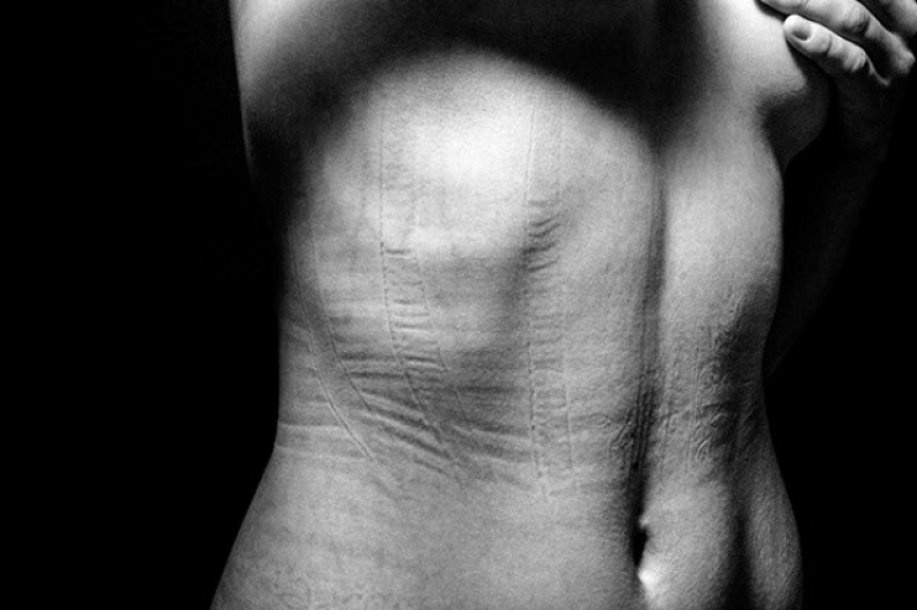 This is what lies behind the female splendor. On these photos even it is painful to watch