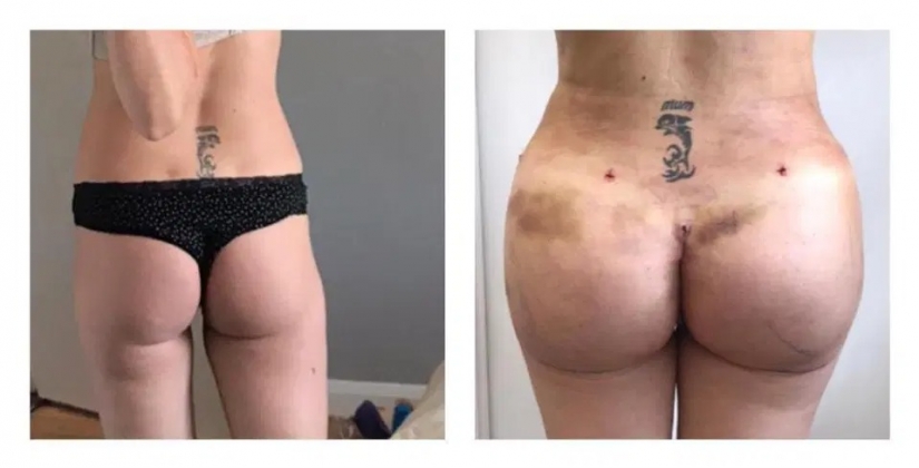 Un nuevo sacerdote — una nueva vida: una mujer se acercó a ella para la cirugía plástica de las nalgas, a pesar de la grave enfermedad del novio