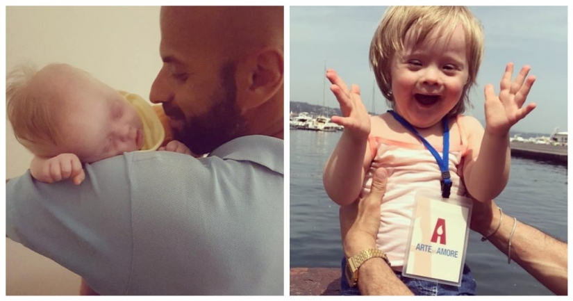 Un rayo de positividad: el hombre adoptó a una niña con síndrome de down, después de que fue abandonada a 20 familias