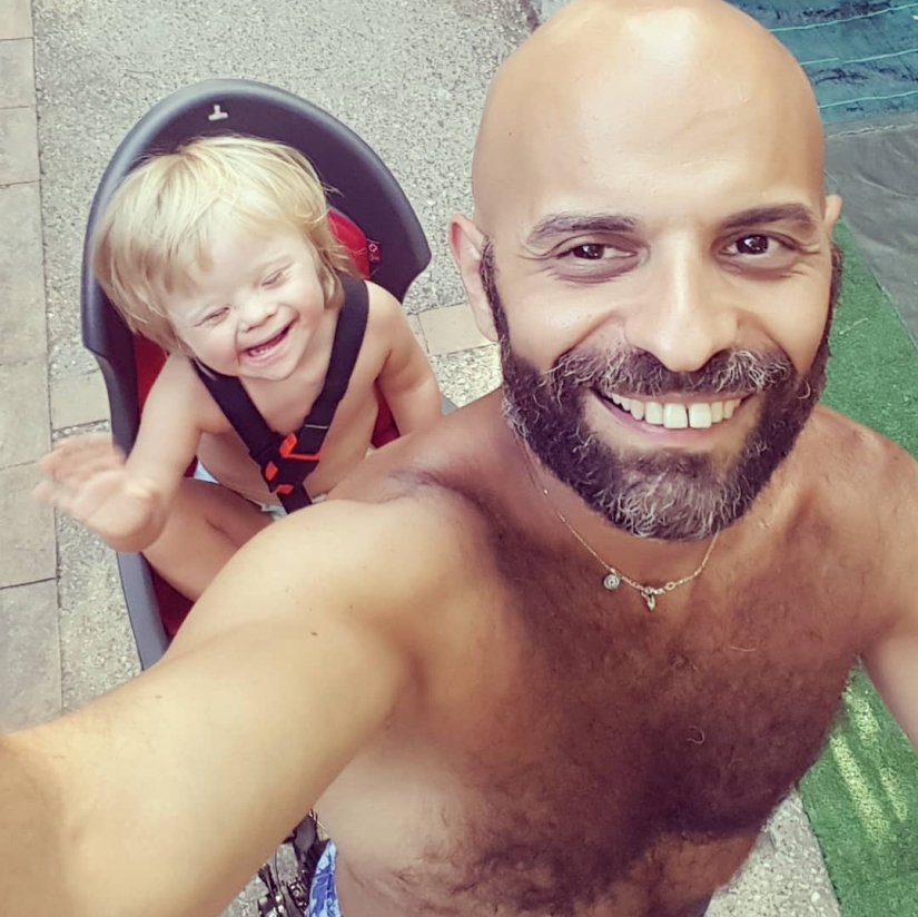 Un rayo de positividad: el hombre adoptó a una niña con síndrome de down, después de que fue abandonada a 20 familias Un rayo de positividad: el hombre adoptó a una niña con síndrome de down, después de que fue abandonada a 20 familias