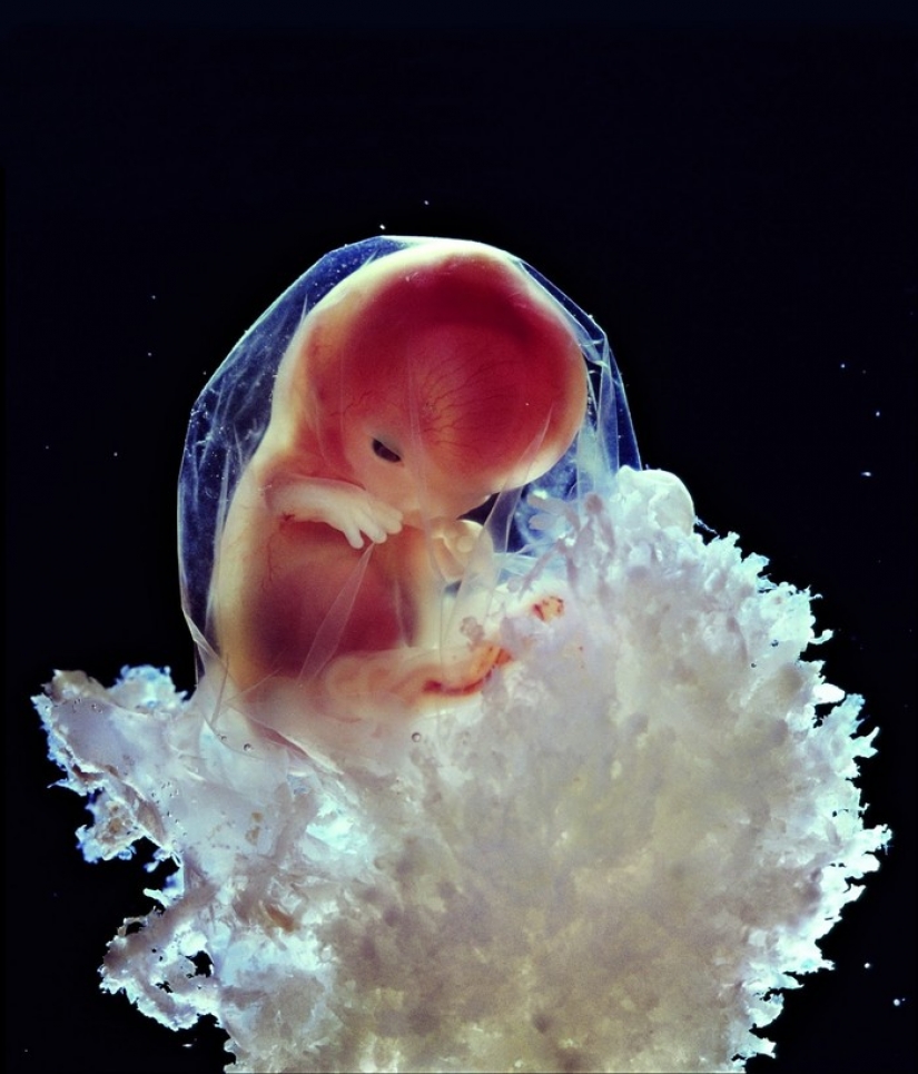 Unique footage from conception to birth Unique footage from conception to birth