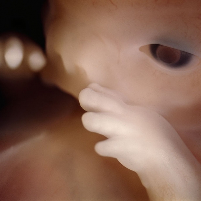 Unique footage from conception to birth Unique footage from conception to birth