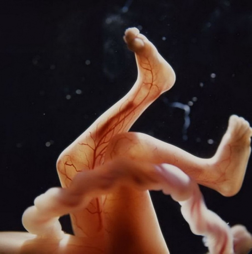 Unique footage from conception to birth Unique footage from conception to birth