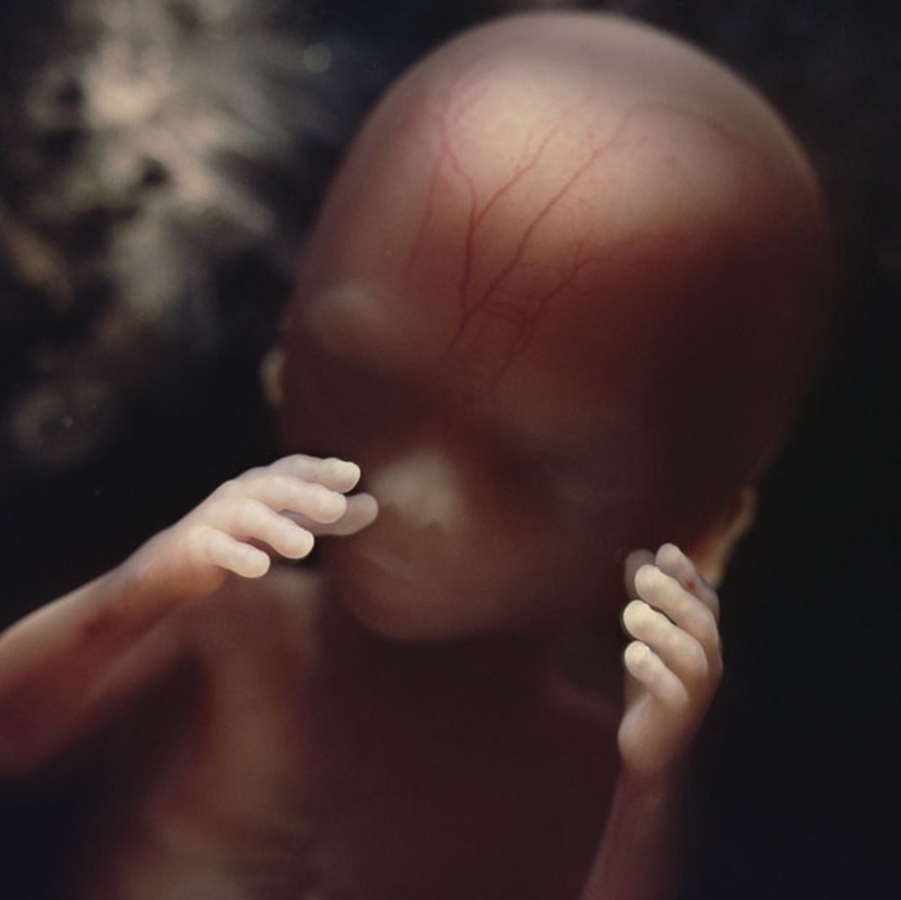Unique footage from conception to birth Unique footage from conception to birth