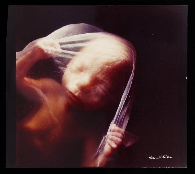 Unique footage from conception to birth Unique footage from conception to birth