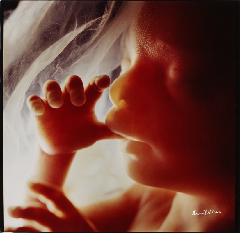 Unique footage from conception to birth Unique footage from conception to birth