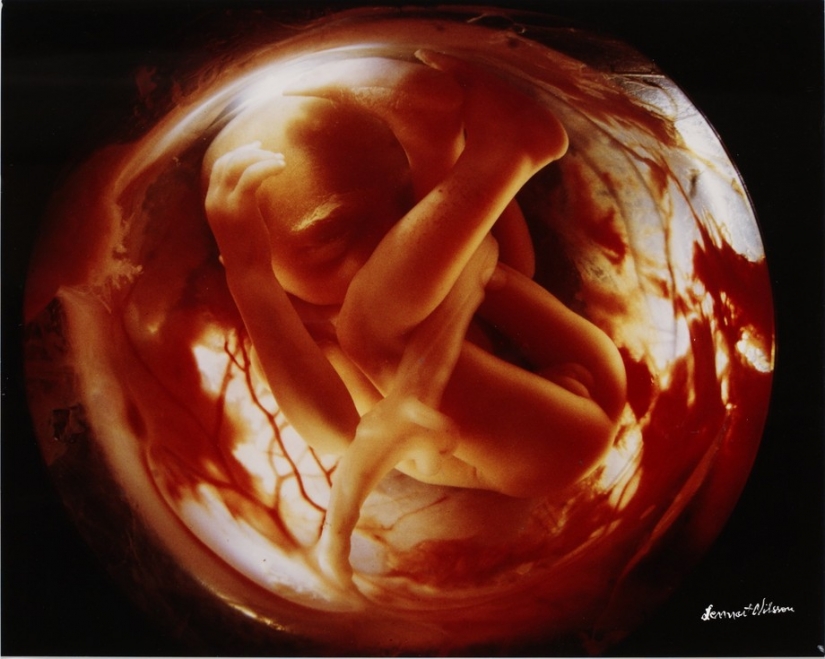 Unique footage from conception to birth Unique footage from conception to birth