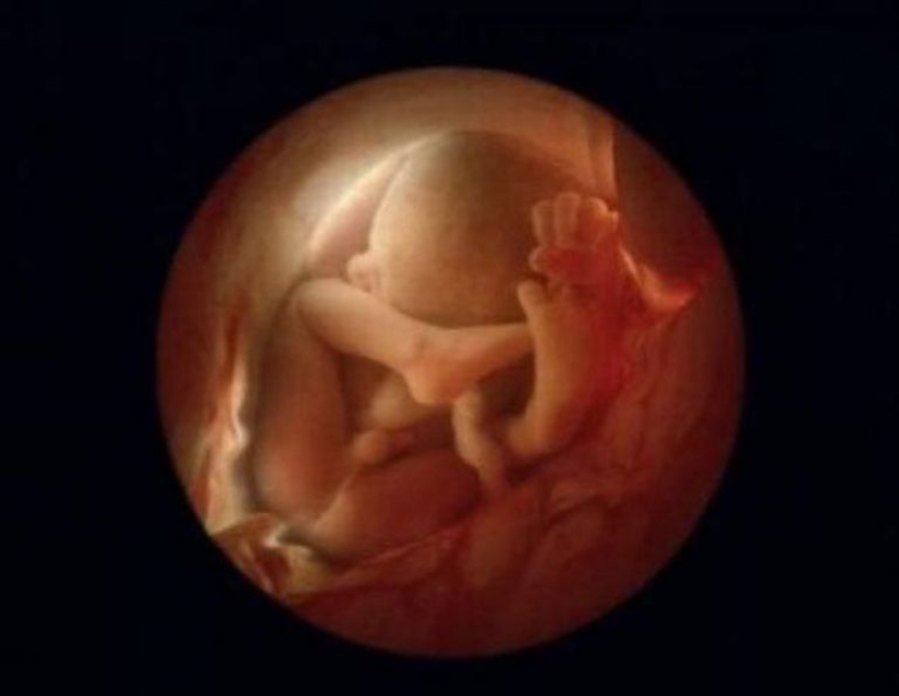 Unique footage from conception to birth Unique footage from conception to birth
