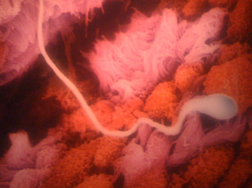 Unique footage from conception to birth Unique footage from conception to birth