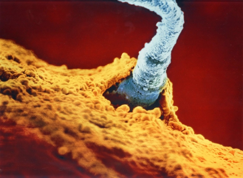 Unique footage from conception to birth Unique footage from conception to birth