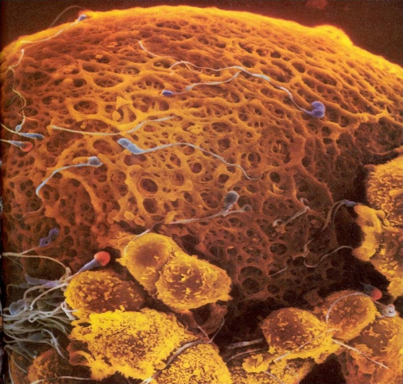 Unique footage from conception to birth Unique footage from conception to birth