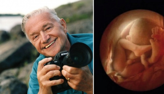 Unique footage from conception to birth