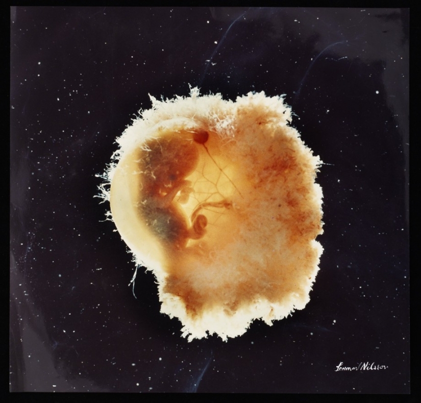 Unique footage from conception to birth Unique footage from conception to birth