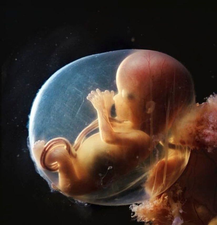 Unique footage from conception to birth Unique footage from conception to birth