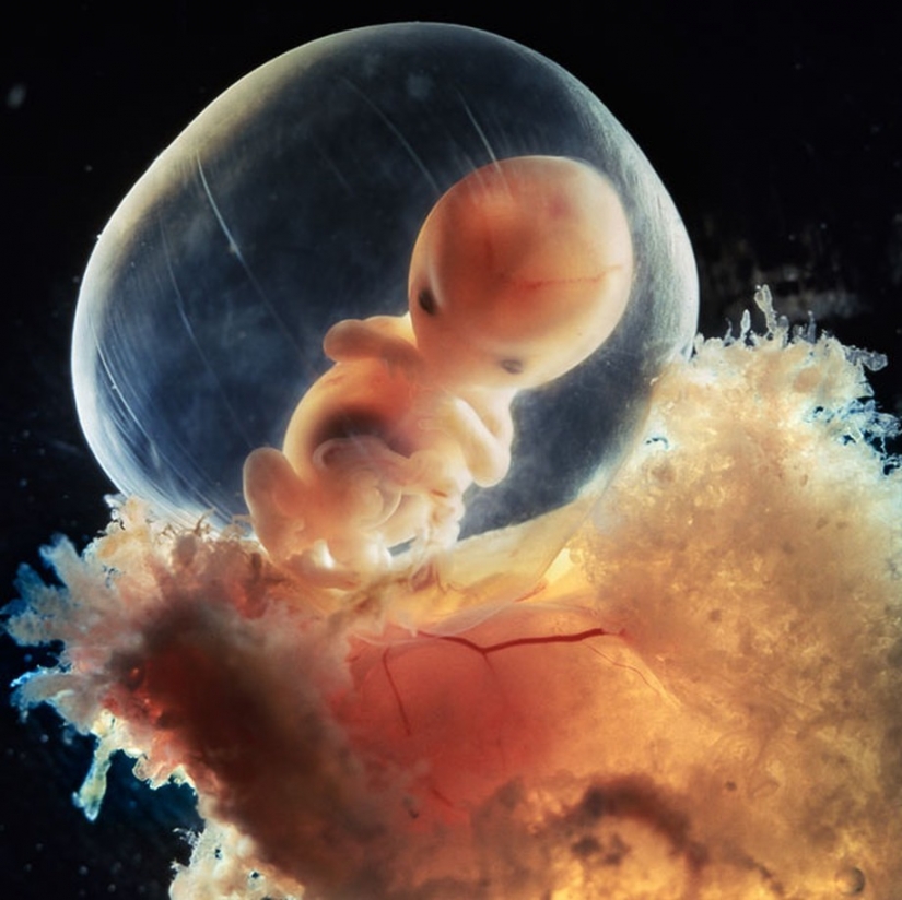 Unique footage from conception to birth Unique footage from conception to birth