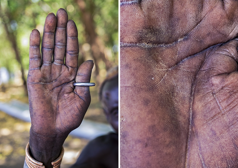 What I can tell human hands. Photo Of Omar Reda