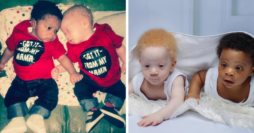 What is the secret of twins with different skin colors from Nigeria