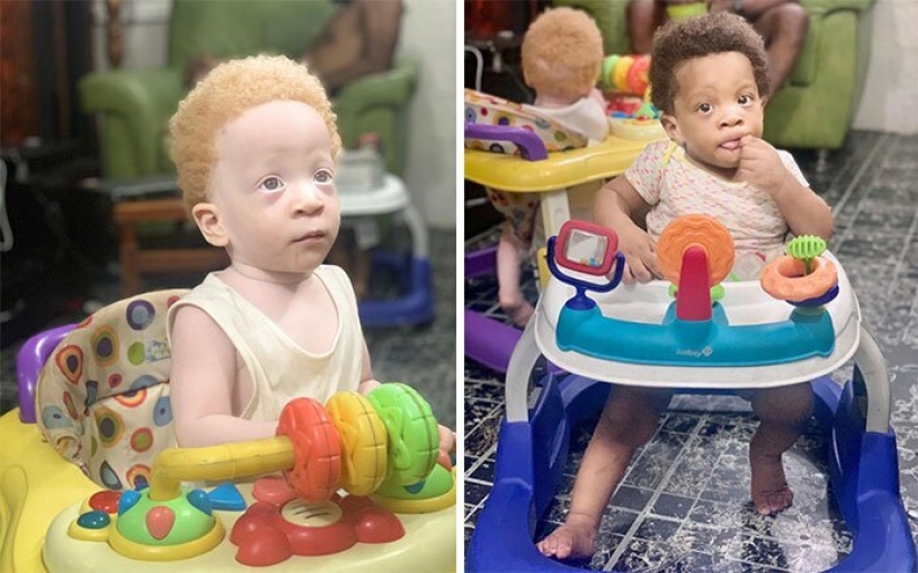 What is the secret of twins with different skin colors from Nigeria What is the secret of twins with different skin colors from Nigeria