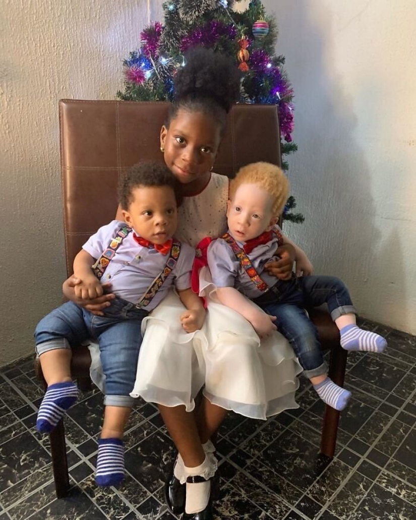 What is the secret of twins with different skin colors from Nigeria What is the secret of twins with different skin colors from Nigeria