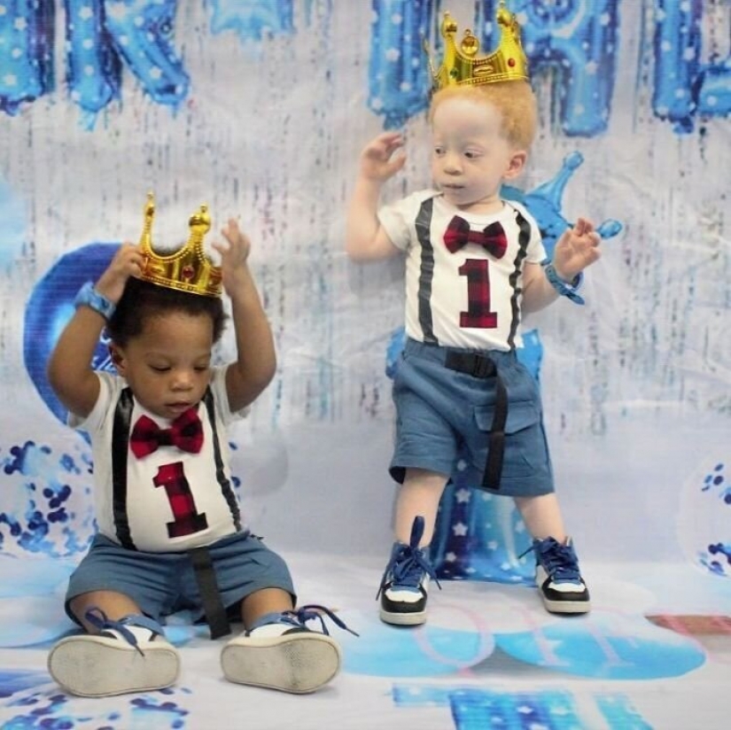 What is the secret of twins with different skin colors from Nigeria What is the secret of twins with different skin colors from Nigeria