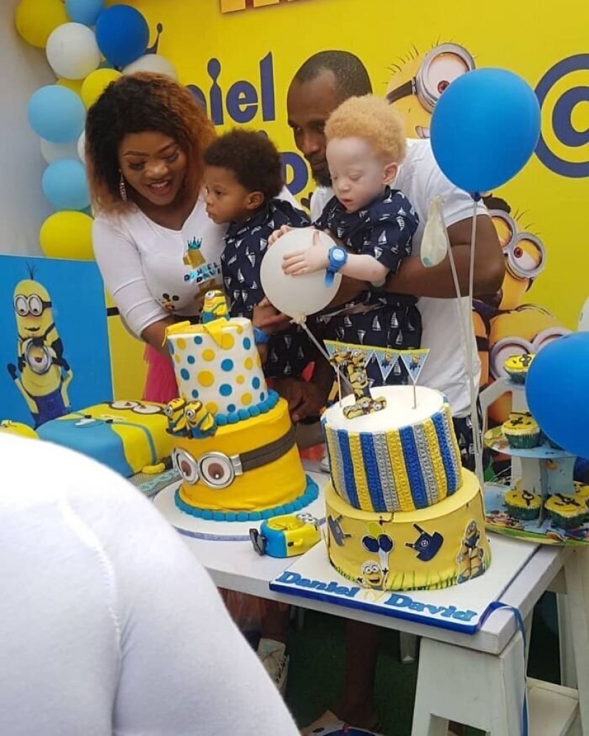 What is the secret of twins with different skin colors from Nigeria What is the secret of twins with different skin colors from Nigeria