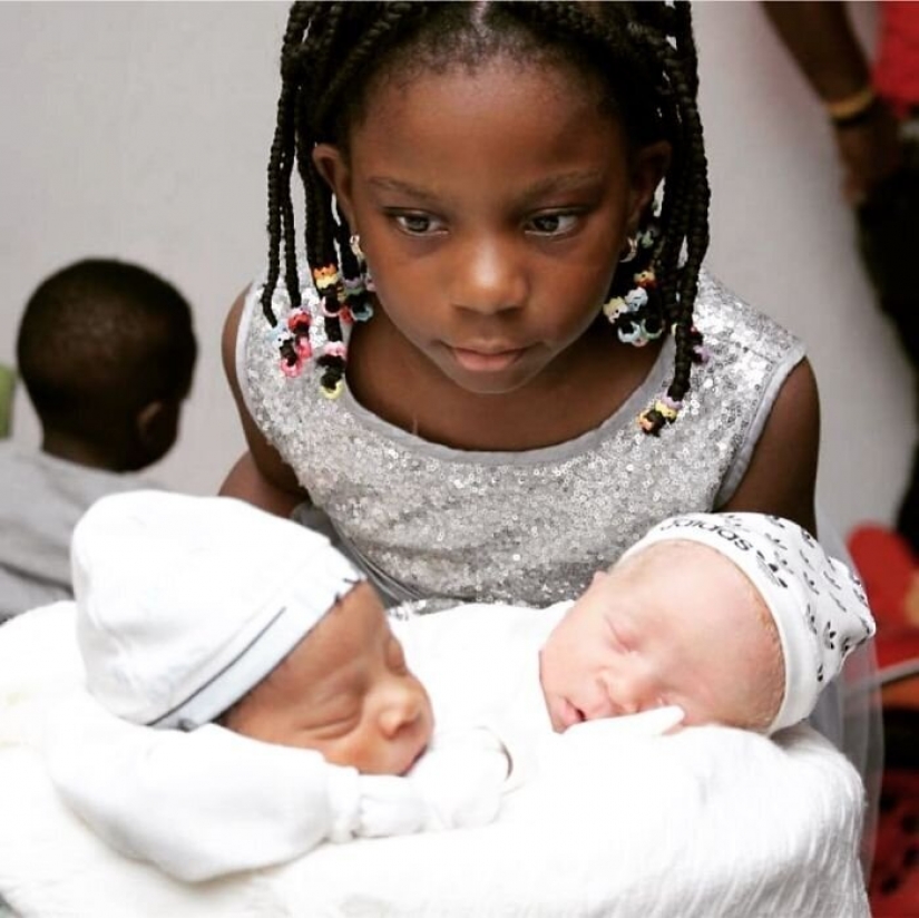 What is the secret of twins with different skin colors from Nigeria What is the secret of twins with different skin colors from Nigeria