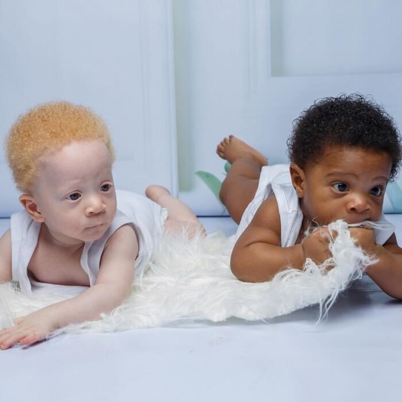 What is the secret of twins with different skin colors from Nigeria What is the secret of twins with different skin colors from Nigeria