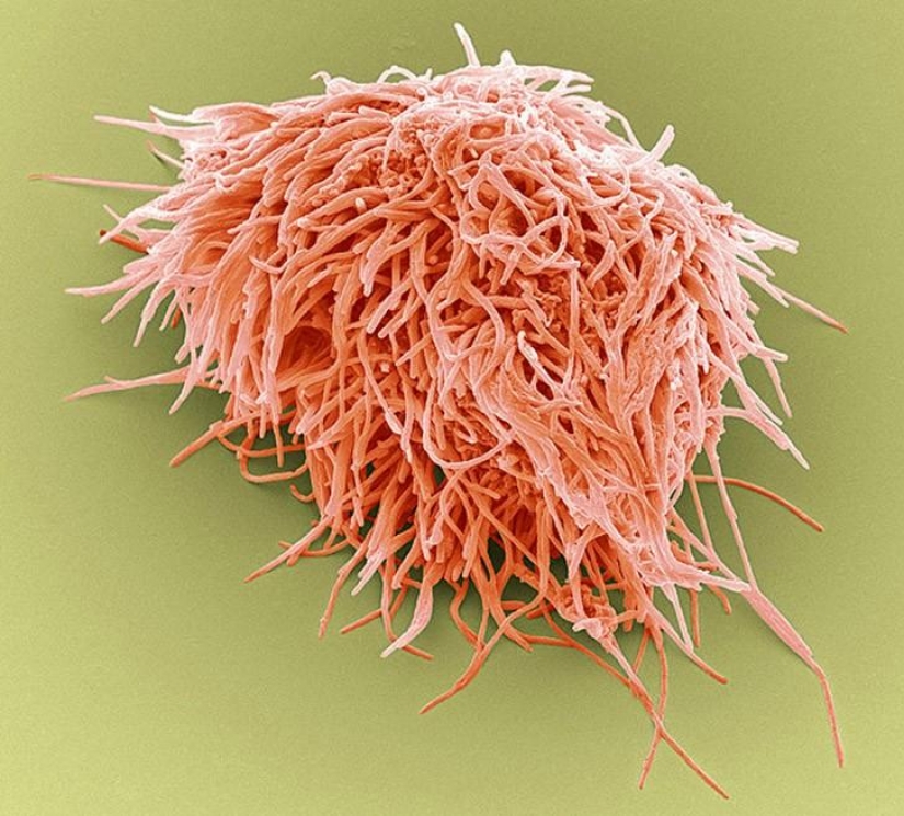 What lurks in your mouth, very closeup What lurks in your mouth, very closeup