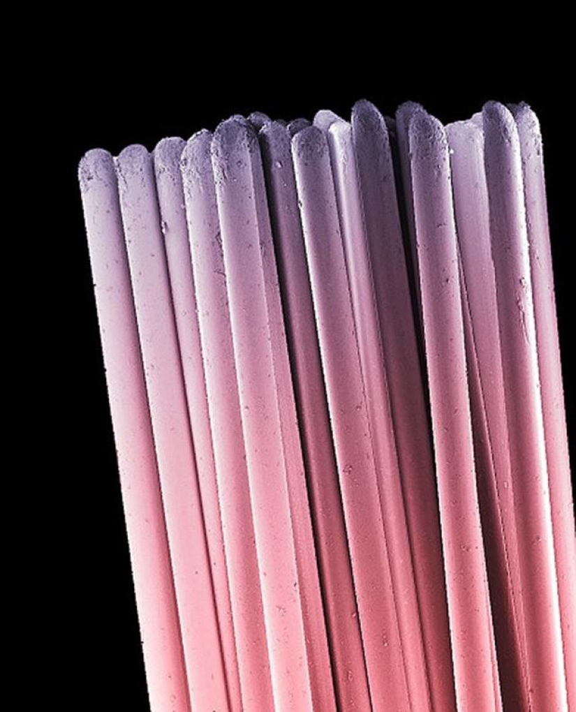 What lurks in your mouth, very closeup What lurks in your mouth, very closeup