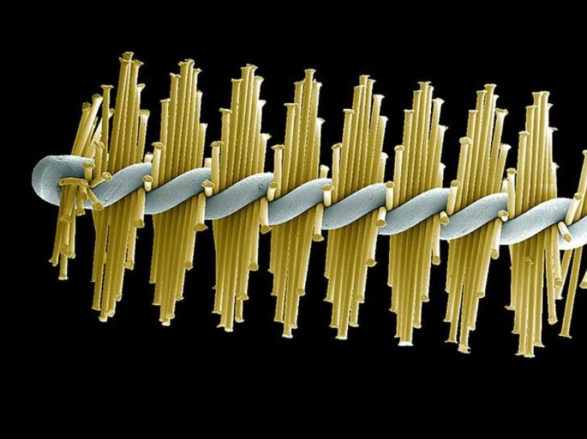 What lurks in your mouth, very closeup What lurks in your mouth, very closeup