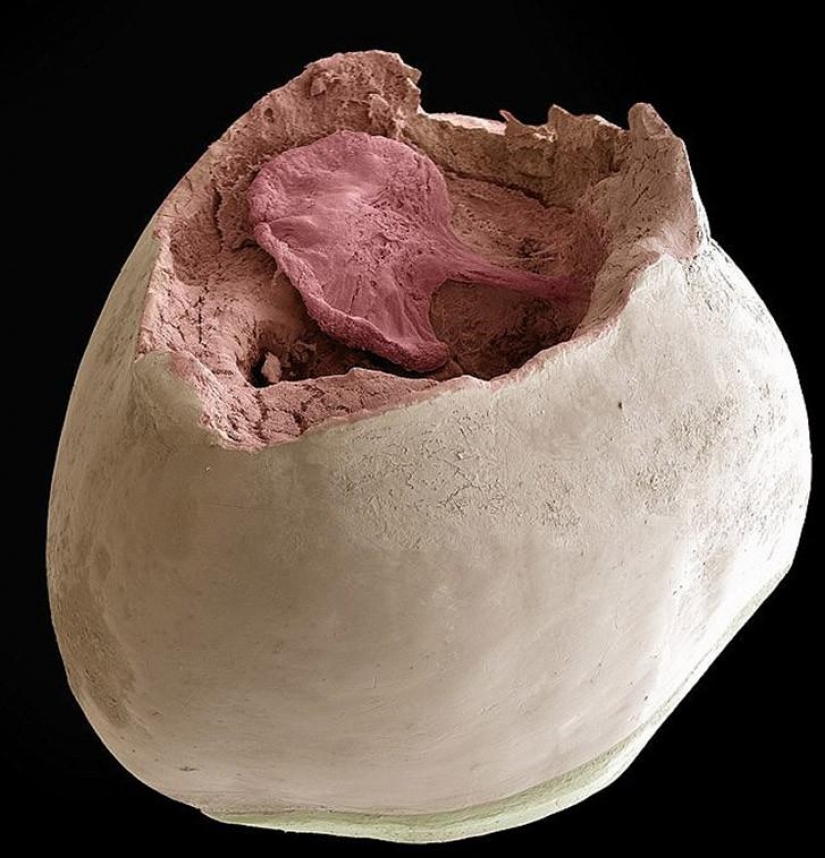 What lurks in your mouth, very closeup What lurks in your mouth, very closeup