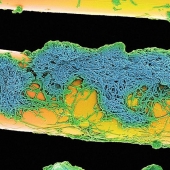 What lurks in your mouth, very closeup