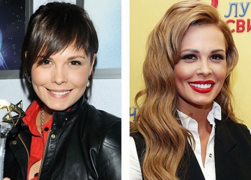 10 bellezas rusas antes y después de la cirugía plástica