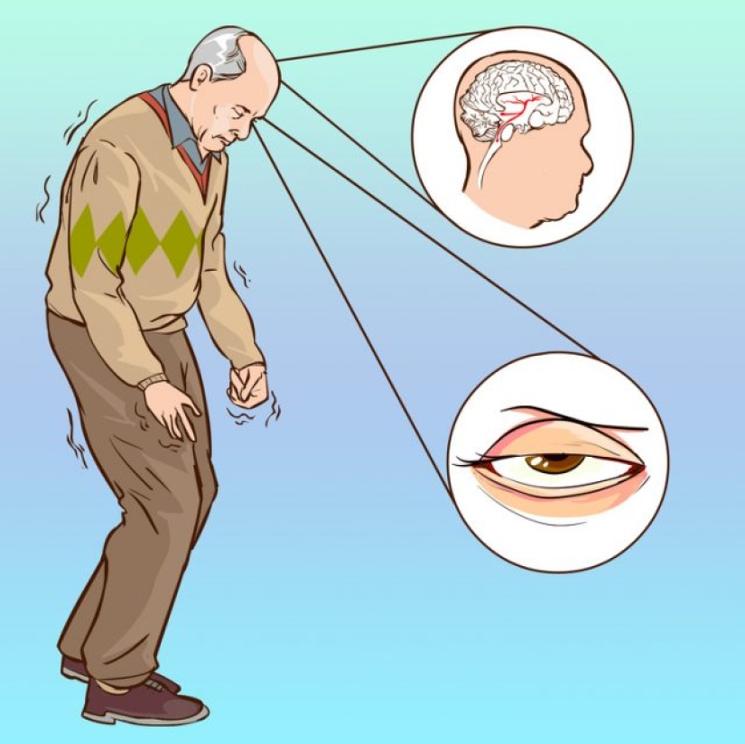 10 causes of sudden visual impairment 10 causes of sudden visual impairment