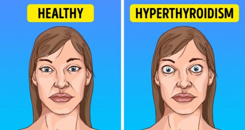 10 causes of sudden visual impairment 10 causes of sudden visual impairment