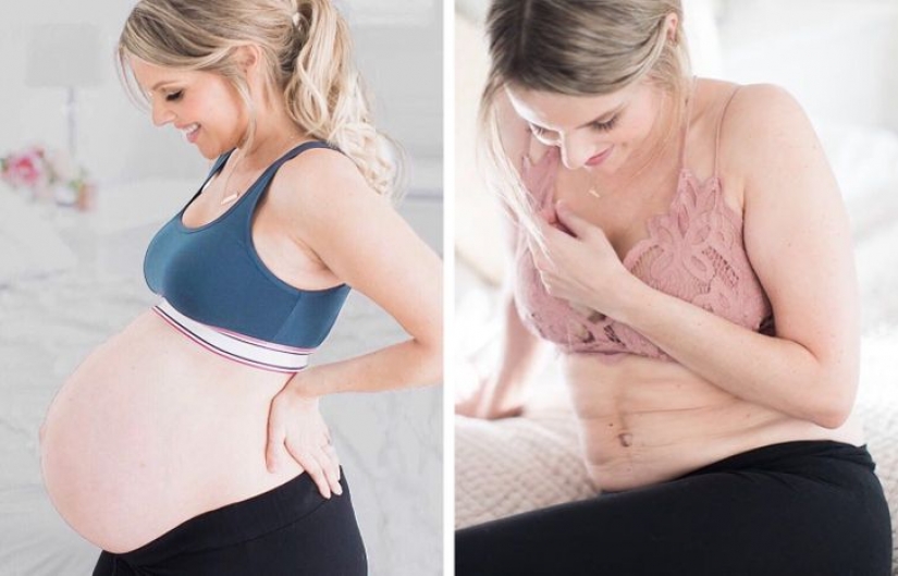 10 celebrity moms who proudly shared their postpartum bodies with the world