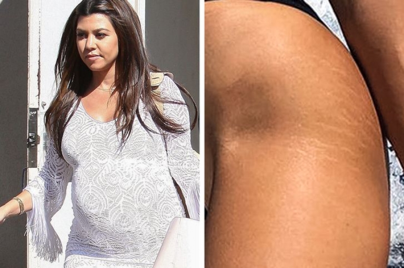 10 celebrity moms who proudly shared their postpartum bodies with the world