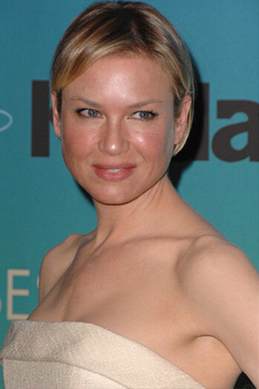 10 estrellas que han tenido cirugía plástica de mentón 10 estrellas que han tenido cirugía plástica de mentón