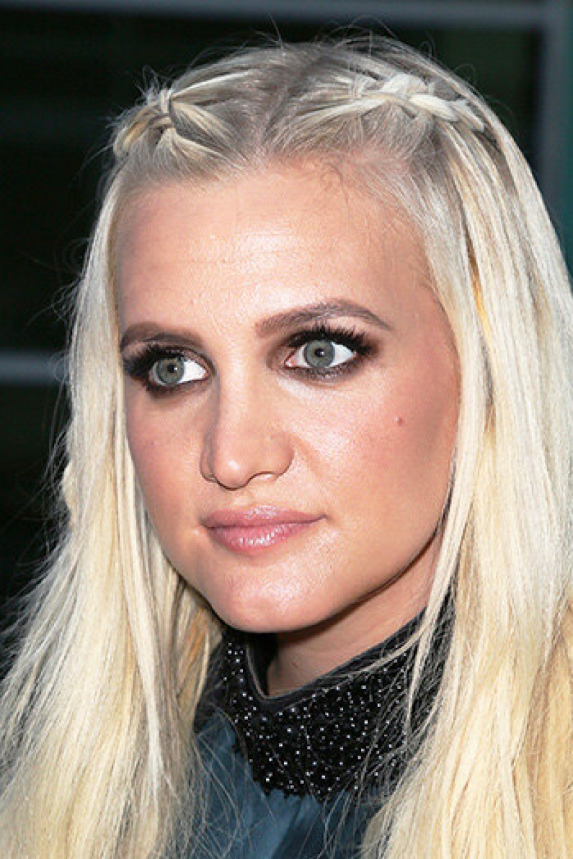 10 estrellas que han tenido cirugía plástica de mentón 10 estrellas que han tenido cirugía plástica de mentón