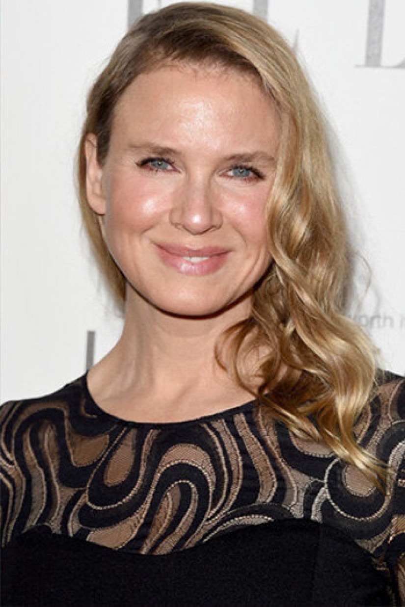 10 estrellas que han tenido cirugía plástica de mentón 10 estrellas que han tenido cirugía plástica de mentón