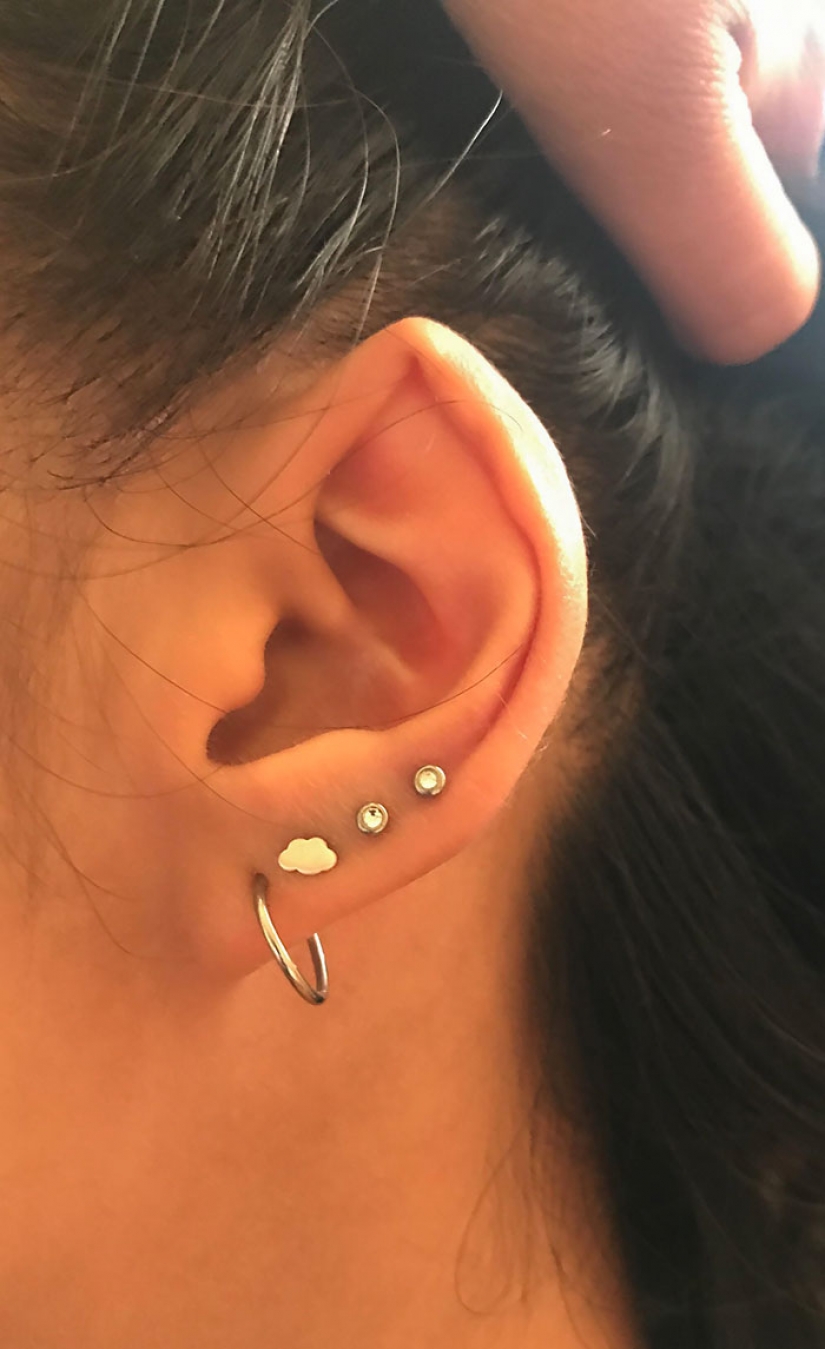 10 personas cuya genética los hizo únicos 10 personas cuya genética los hizo únicos