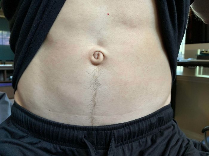 10 personas cuya genética los hizo únicos 10 personas cuya genética los hizo únicos