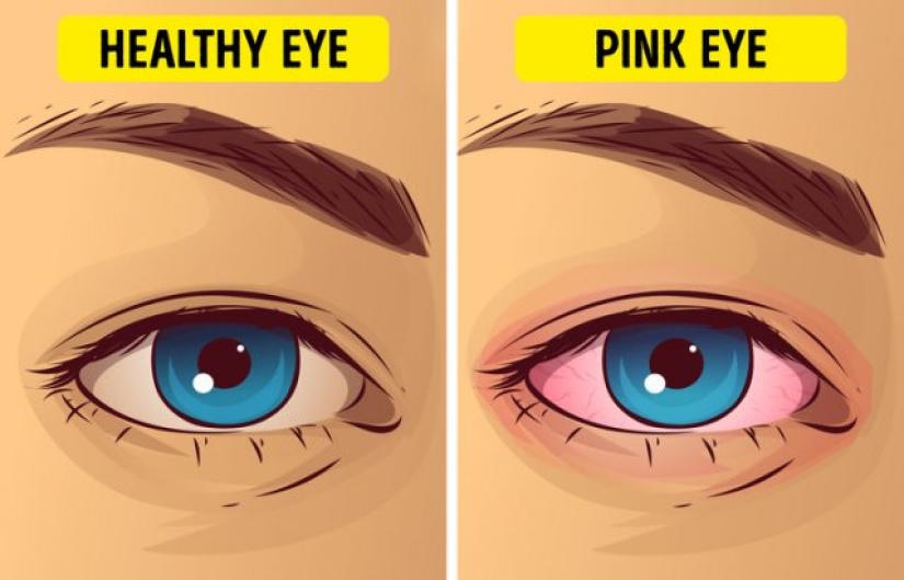 10 razones de la pérdida repentina de la visión