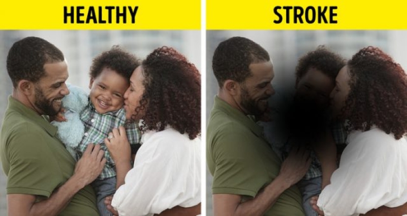 10 razones de la pérdida repentina de la visión