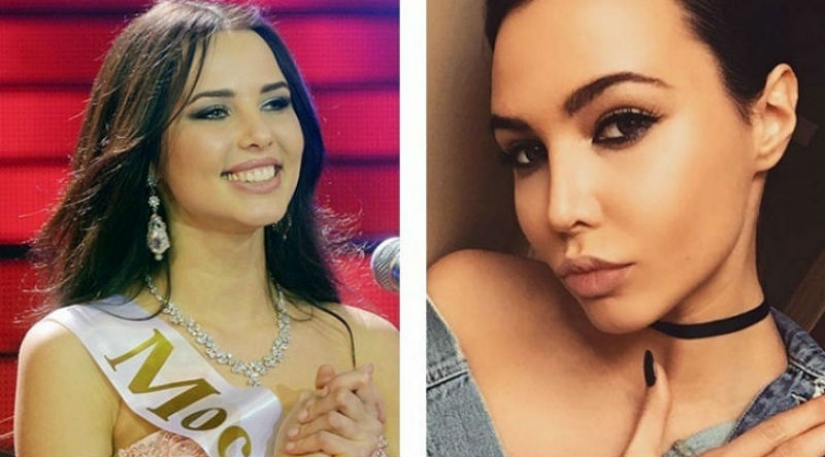 10 Russian beauties before and after plastic surgery