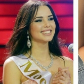 10 Russian beauties before and after plastic surgery