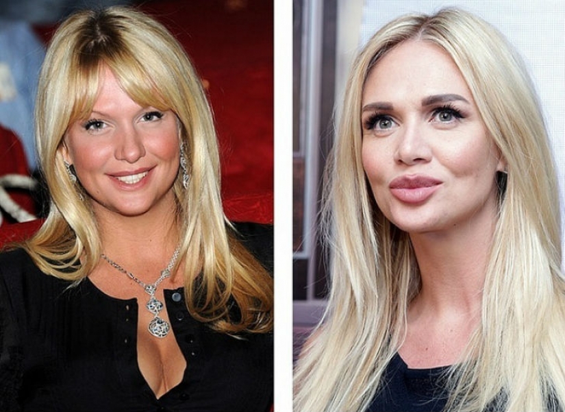 10 Russian beauties before and after plastic surgery