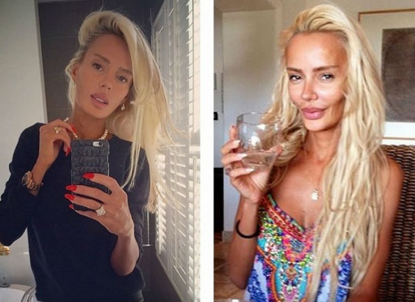 10 Russian beauties before and after plastic surgery