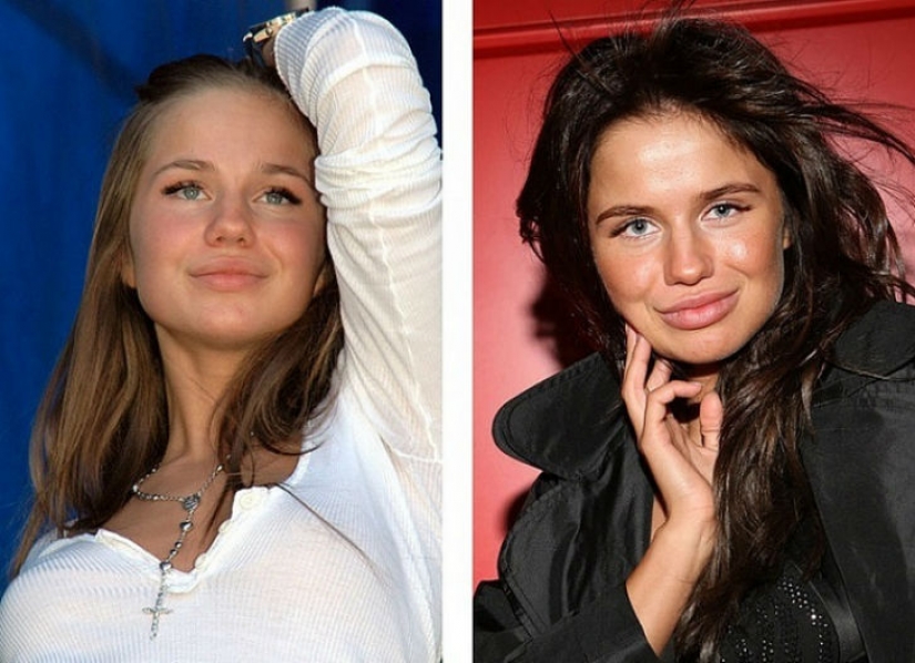 10 Russian beauties before and after plastic surgery